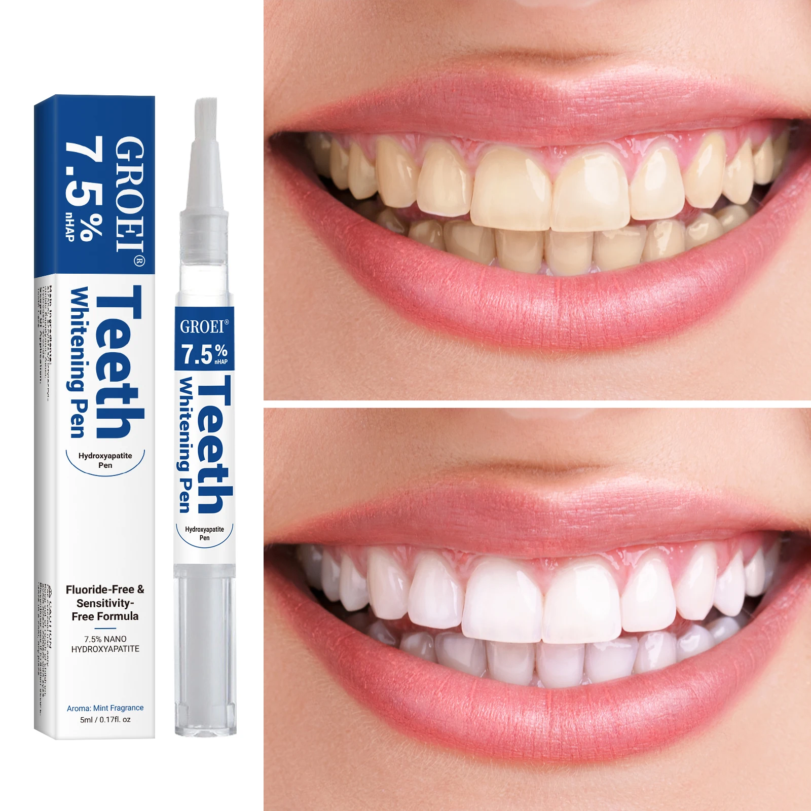هيدروكسياباتيت تبييض الأسنان ا - مراجعة Teeth Whitening Pen وسعره