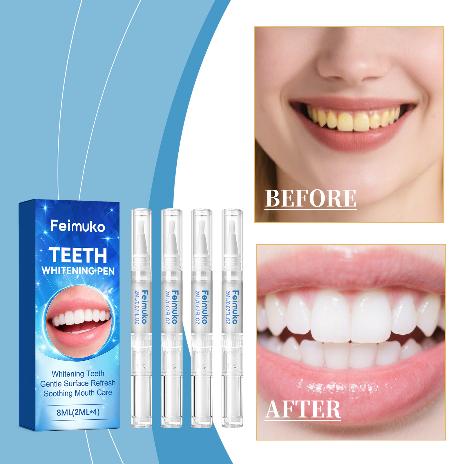قلم جل للأسنان من فيموكو 8 مل، - مراجعة Teeth Whitening Pen وسعره
