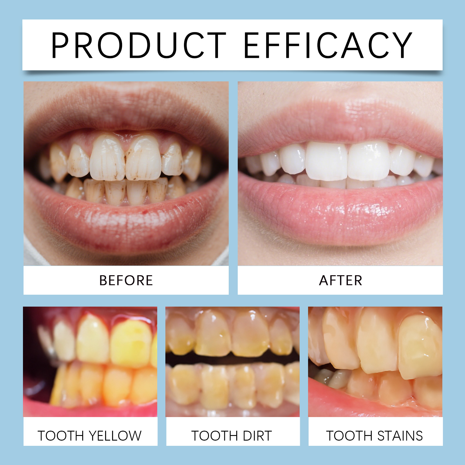 قلم جل للأسنان من فيموكو 8 مل، - مراجعة Teeth Whitening Pen وسعره