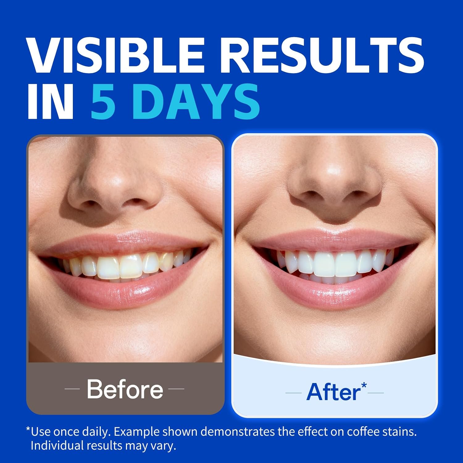 شرائط تبييض الأسنان (1/7 زوج)  - مراجعة Teeth Whitening Strips Crest وسعره